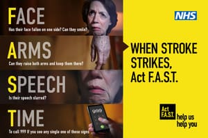 Signs and Symptoms of Strokes 7 Signs and Symptoms of Strokes